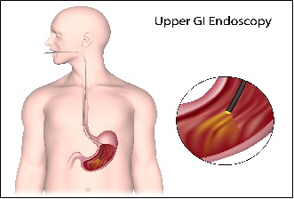 GI Endoscopy
